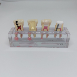 Endodontisk Studiemodel